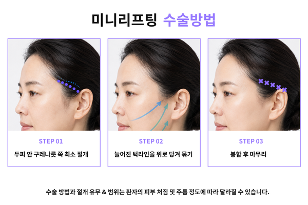 리팅성형외과-서울점_미니리프팅_미니리프팅절개_리프팅수술방법.png %EB%A6%AC%ED%8C%85%EC%84%B1%ED%98%95%EC%99%B8%EA%B3%BC-%EC%84%9C%EC%9A%B8%EC%A0%90_%EB%AF%B8%EB%8B%88%EB%A6%AC%ED%94%84%ED%8C%85_%EB%AF%B8%EB%8B%88%EB%A6%AC%ED%94%84%ED%8C%85%EC%A0%88%EA%B0%9C_%EB%A6%AC%ED%94%84%ED%8C%85%EC%88%98%EC%88%A0%EB%B0%A9%EB%B2%95.png