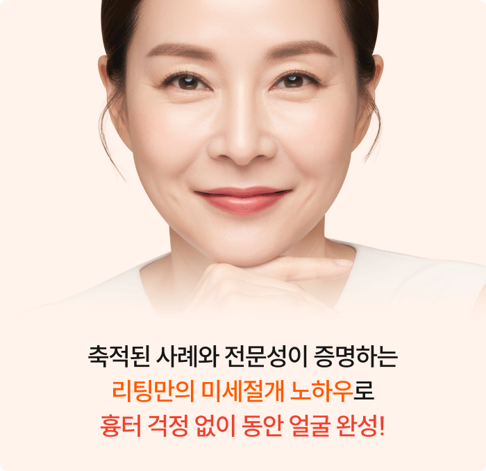 인중축소술 예시 이미지