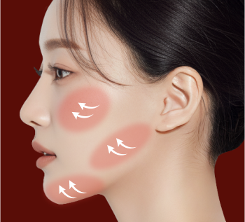 1단계 미니윤곽술 리프팅