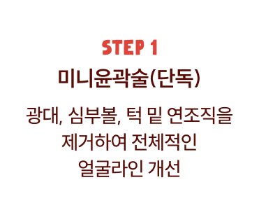 1단계 미니윤곽술 리프팅