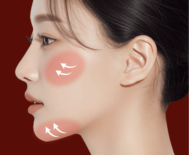 1단계 미니윤곽술 리프팅