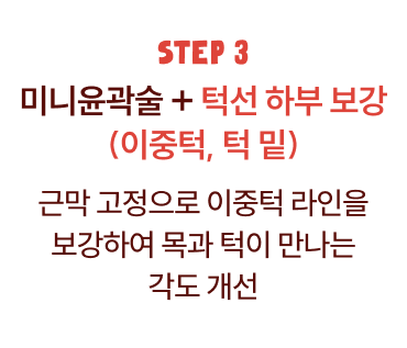 1단계 미니윤곽술 리프팅