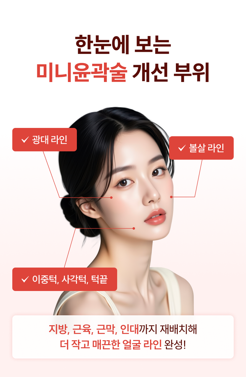 미니윤곽술 개선 부위 - 광대,볼살,턱라인