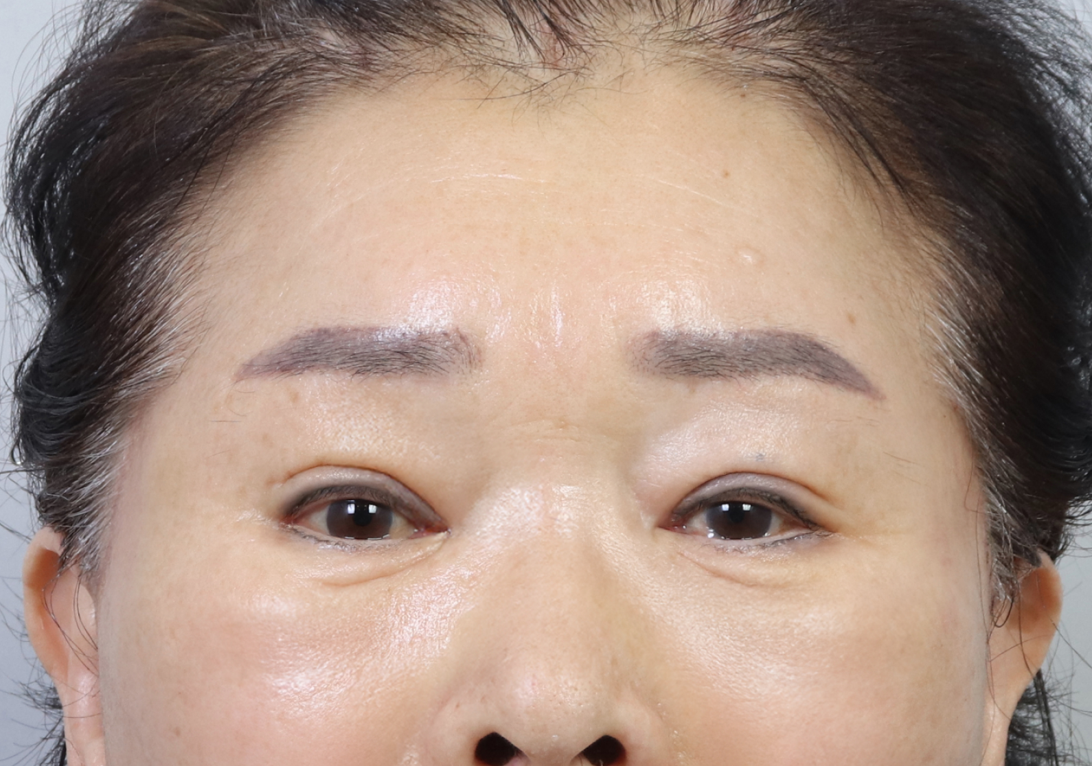 upper_01_after