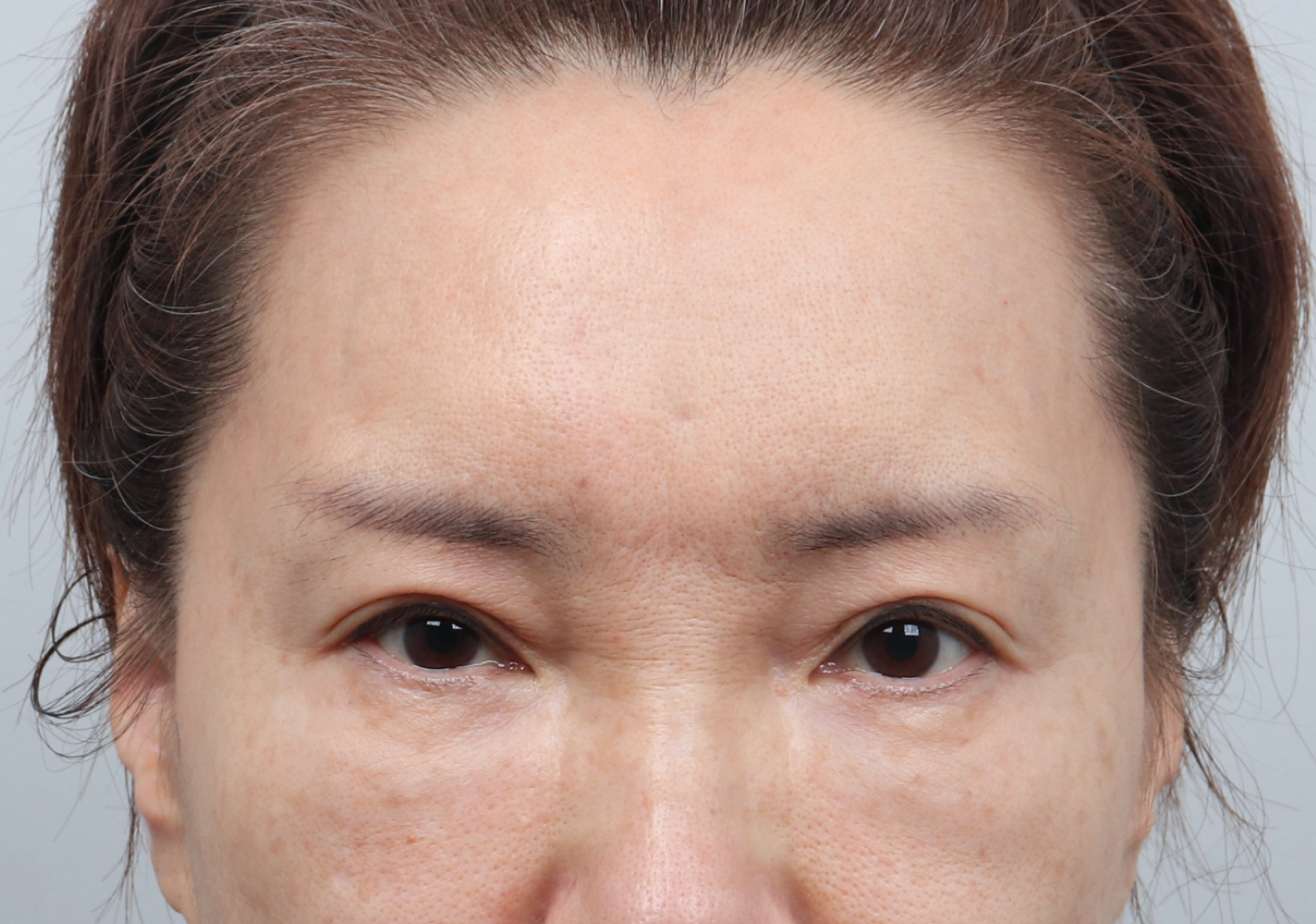 upper_02_before