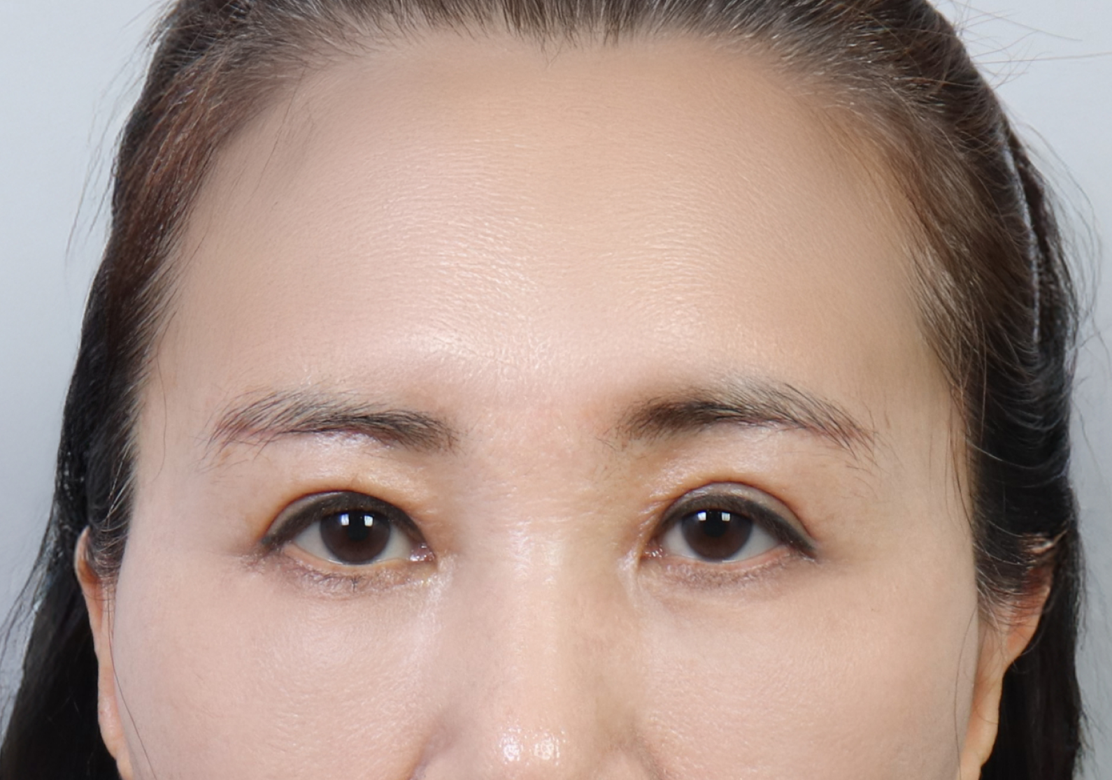 upper_03_after