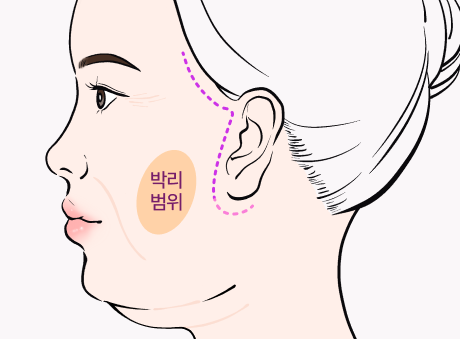 step 02