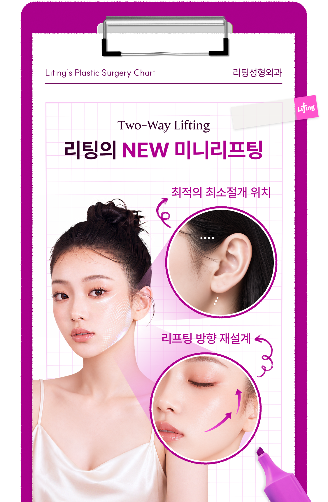 리팅의 NEW 미니리프팅