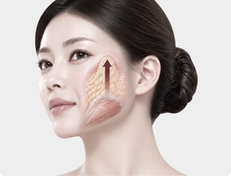 일반 수직 리프팅