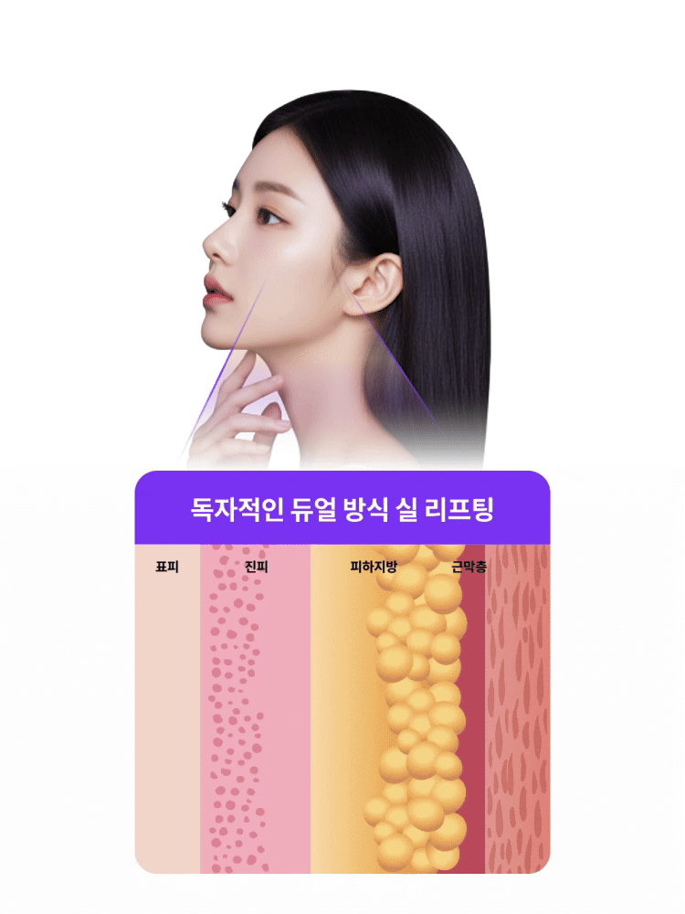 독자적인 듀얼 방식 실 리프팅. 피부진피층에서 한 번 넣어주고, 근막층에서 한번 더 넣어주고, 중간지점을 묶고 당겨 고정력을 높여주는 듀얼 방식!
