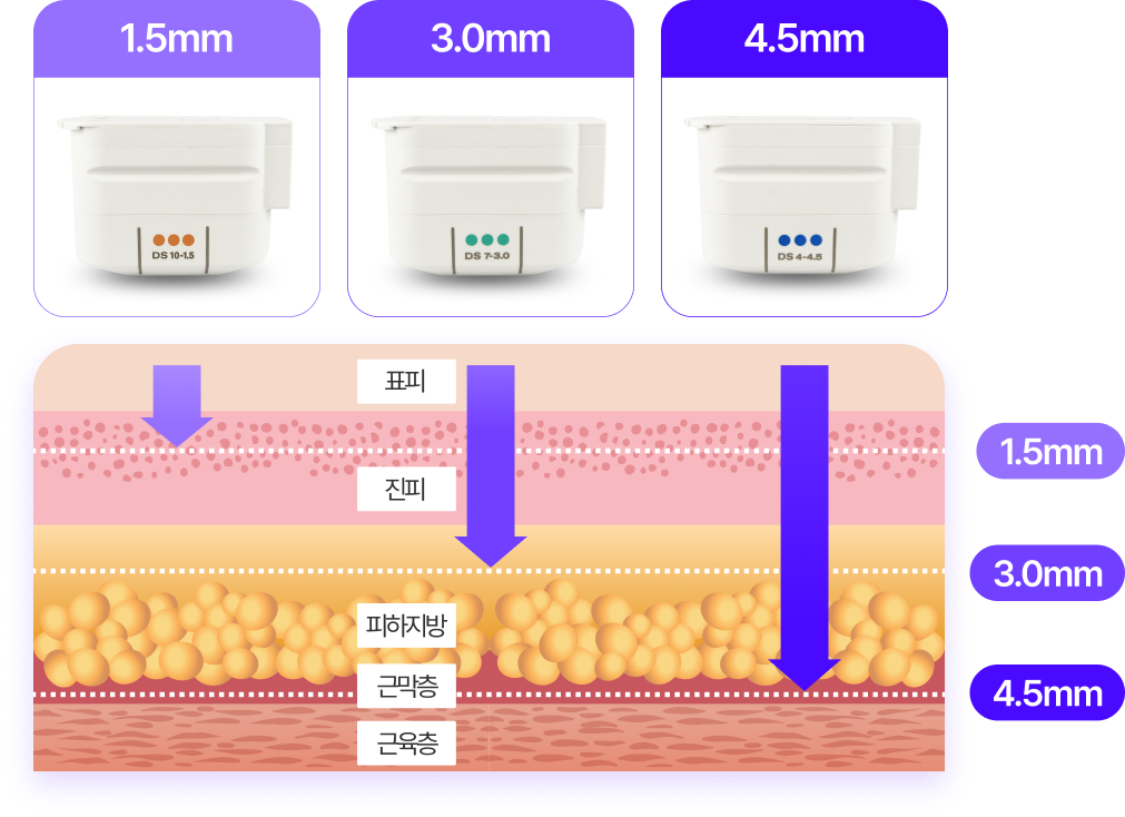 표피&진피 : 1.5mm, 피하지방 상층 : 3.0mm, 피하지방 하층&근막층&근육층 : 4.5mm